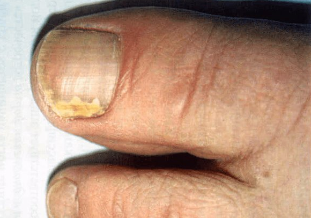 Anerer sprooch liesen